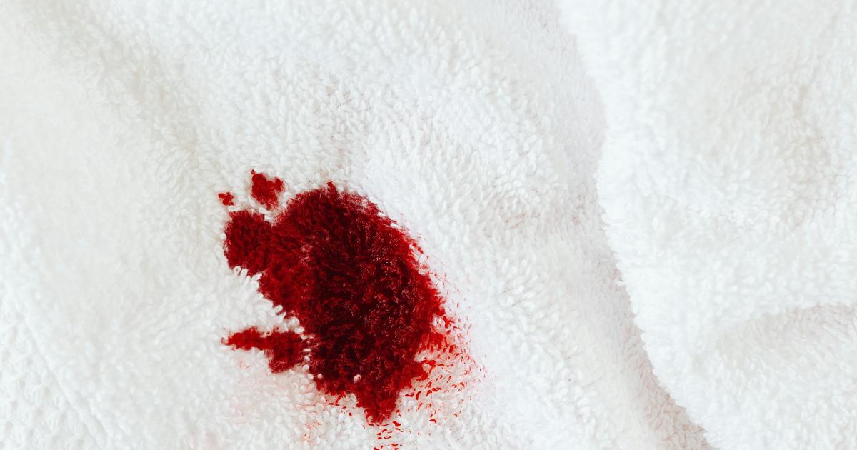 Jak vyčistit skvrny od krve ze sedačky a oblečení | Youklid